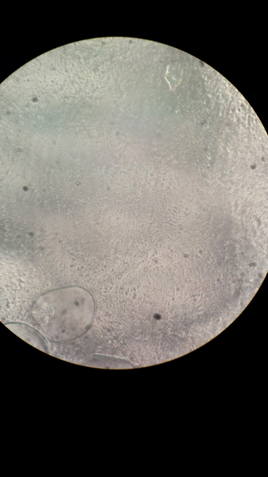 Temas Selectos De Biología. MicroLunas Práctica 1. Muestra de Yakult